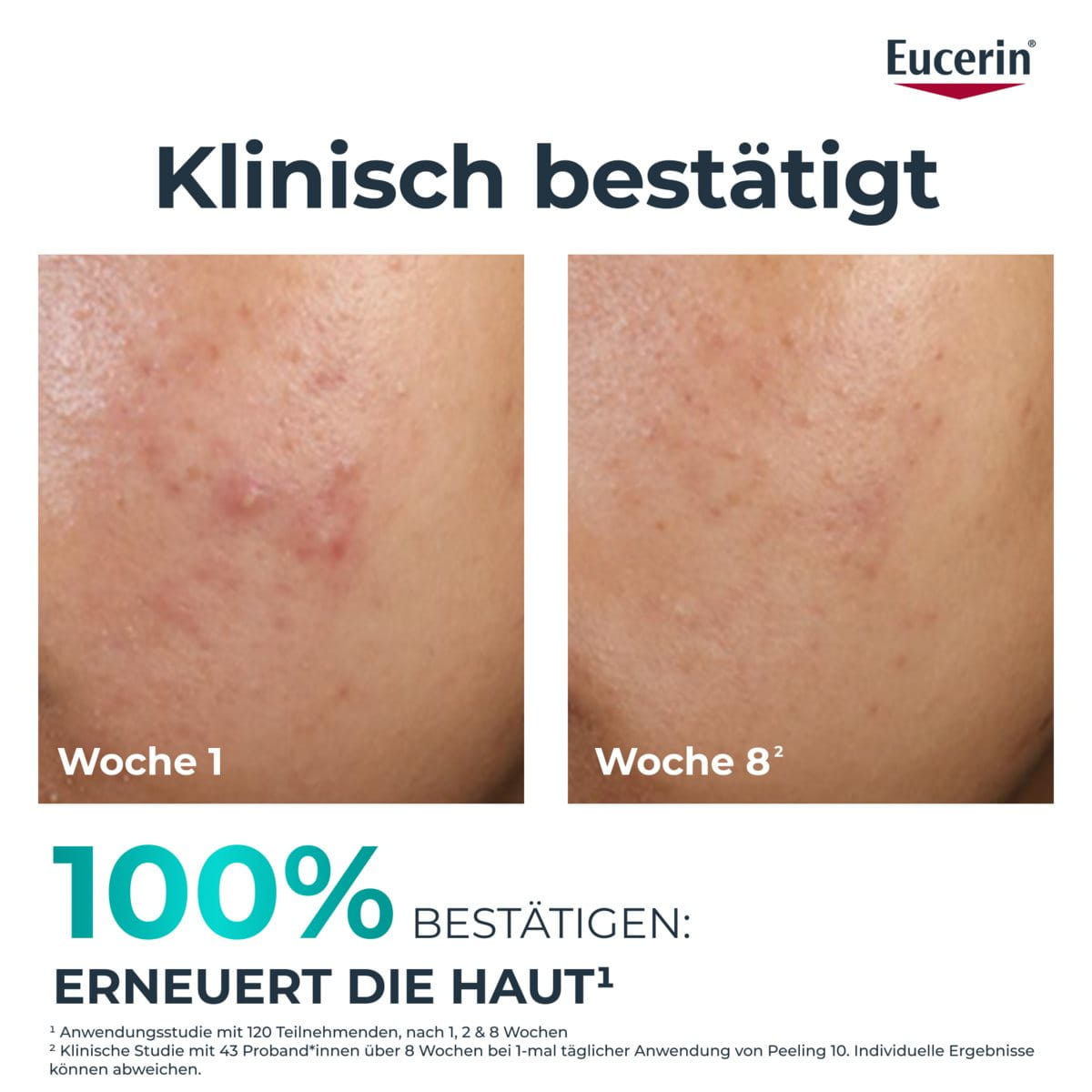 DERMOPURE CLINICAL PEELING 10 – Bild 3