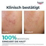DERMOPURE CLINICAL PEELING 10 – Bild 3