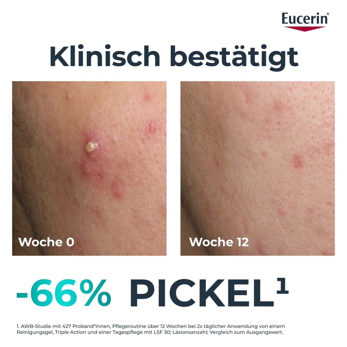 DERMOPURE CLINICAL TRIPLE ACTION – Bild 3